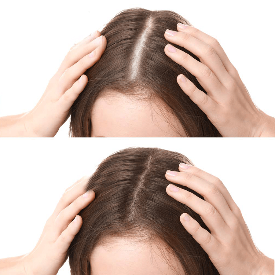 Natural Rosemary Oil (Pack of 2)